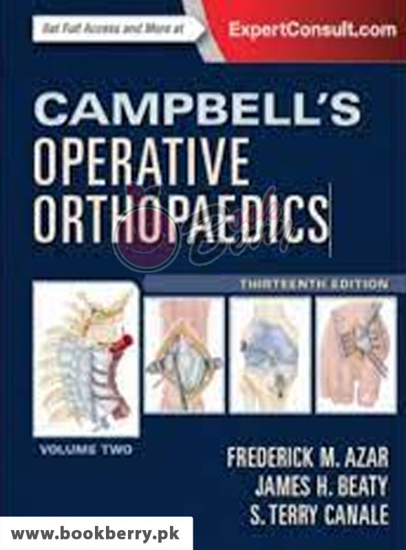 Buy Campbells Operative Orthopaedics 13th Edition (4-Volume Set ) (BKB ...