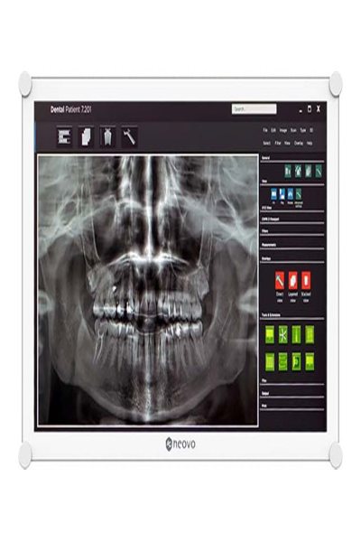 AG Neovo DR2202 22" Dental monitor FHD - Flat Screen - 55.9 cm