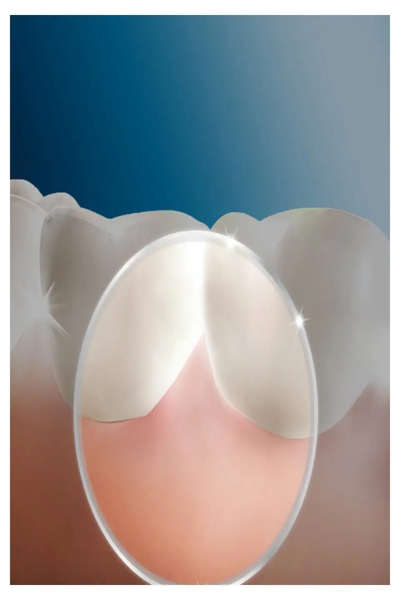 Braun Oral-B OxyJet JAS23 Oral shower - 841396