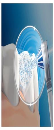 Braun Oral-B OxyJet JAS23 Douche buccale