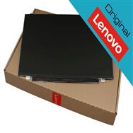 01FR307